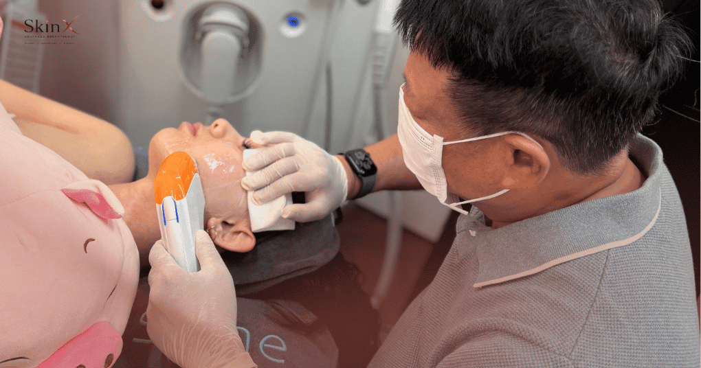 Làm HIFU có bị hóp má, mất mỡ không?
